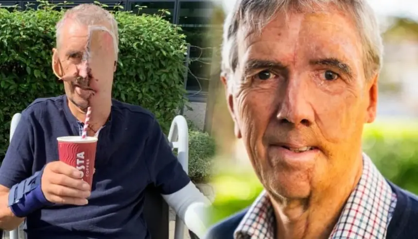 بريطاني-يستعيد-ملامحه-بوجه-مطبوع-ثلاثي-الأبعاد-بعد-حادث-مروع