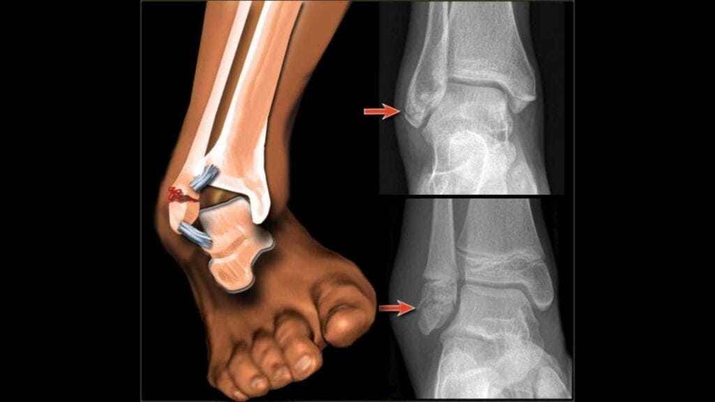 شاب-من-بن-الطيب-يواجه-مصير-المجهول-بعد-كسر.-والمستشفى-يطلب-الانتظار-أو-التوجه-لمصحة-خاصة