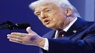 ترامب-يشرح-سبب-الكدمة-في-يده-اليسرى