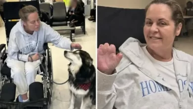 رحلة-تجميل-تنتهي-بمأساة.-سيدة-كندية-تفقد-أطرافها-بعد-مضاعفات-خطيرة-خارج-البلاد